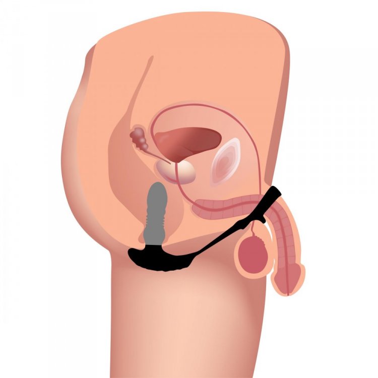 THUNDERPLUGS 10X THRUSTING PLUG W/ COCK & BALL RING - XRAG970